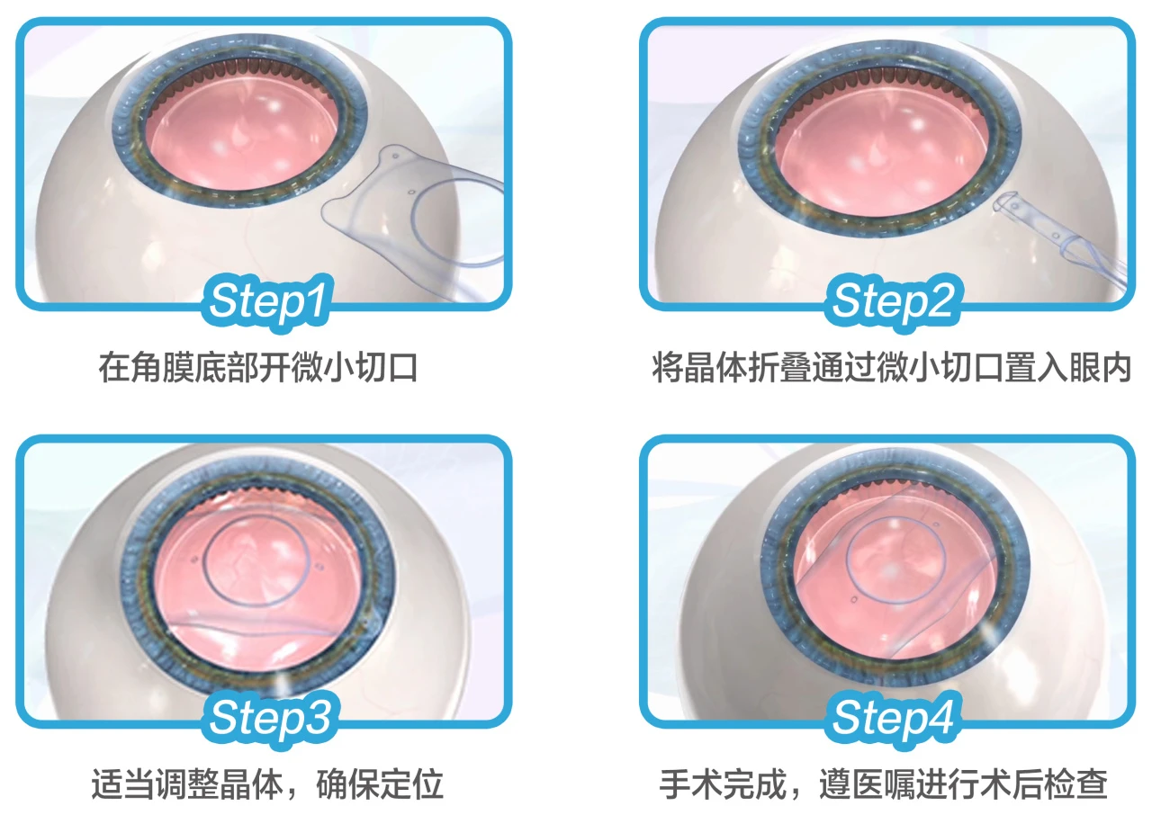 0caf198c2fb381f3996ed150e91a4603.jpg