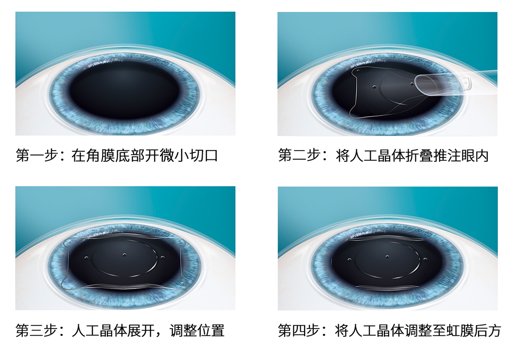 5357bd2ab2ac8c65b730270e110254ad.png