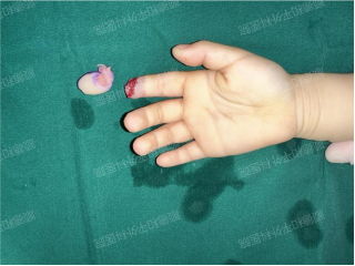 1740818148115437.png image.png