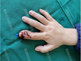 1740818188802476.png image.png