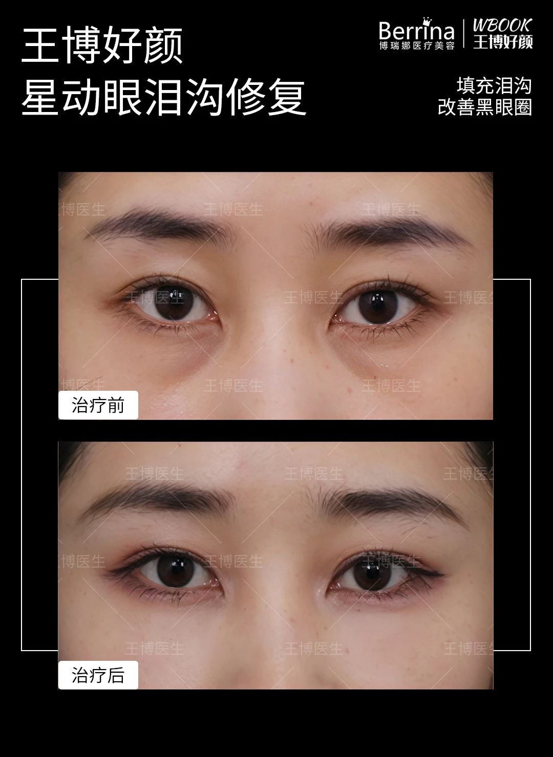 d8ea474fc3e795cffa14ce721db7768f.jpg