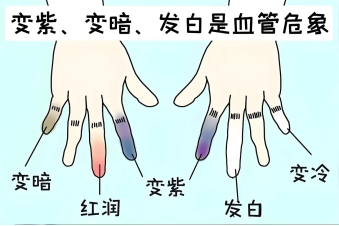 指尖上的“生死时速”——顺德和平外科医院3岁男童断指再植纪实 指尖上的“生死时速”——顺德和平外科医院3岁男童断指再植纪实