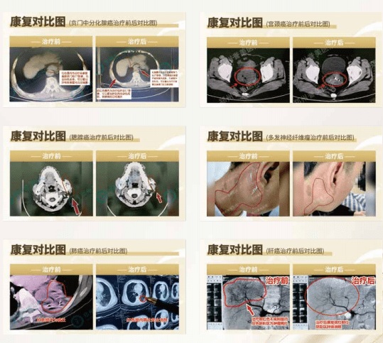 360��ͼ20251212151206 (NXPowerLite ����).png